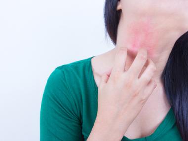 face rash mystery diagnosis
