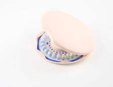 Best birth control options besides the pill