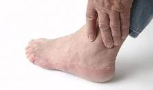 What is Gout?